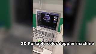 Máquina Doppler color portátil US15 Plus 2D