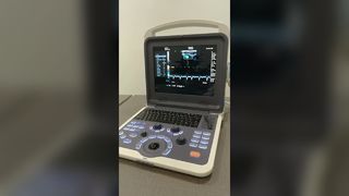 Máquina de ultrasonido BR-US22