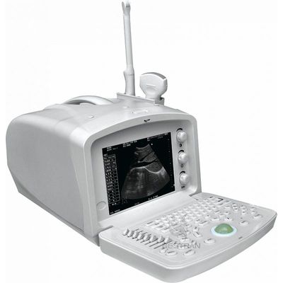 Digital Portable Ultrasonic Diagnosis Equipment...