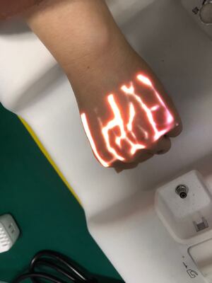 Vein finder machine