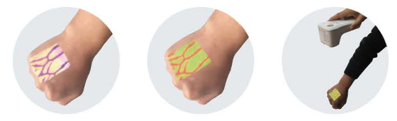Vein finder machine