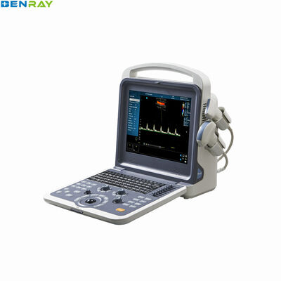 Sistema de diagnóstico ultrasónico Doppler color portátil 80 elementos