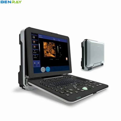 Dispositivo de ultrasonido médico 4D Máquina Doppler portátil de color